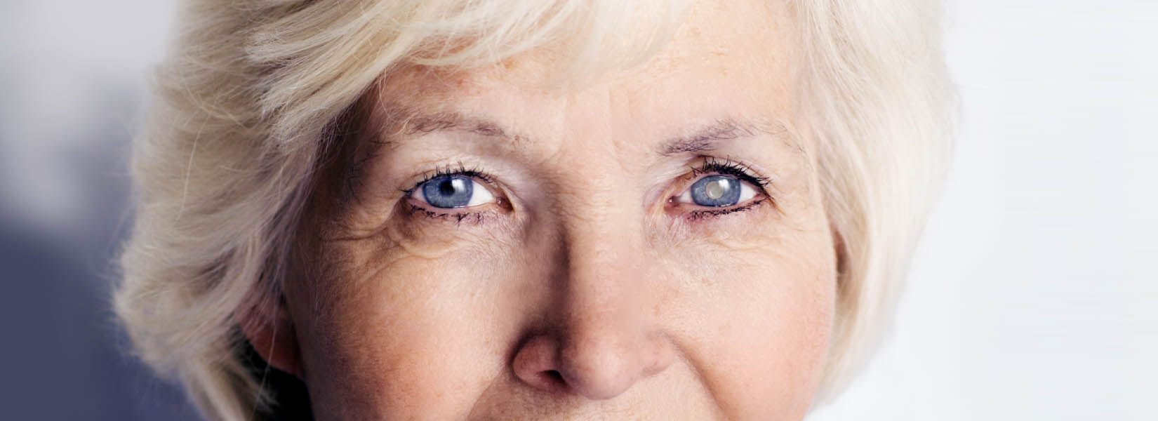 Cataract Surgery in Thornton